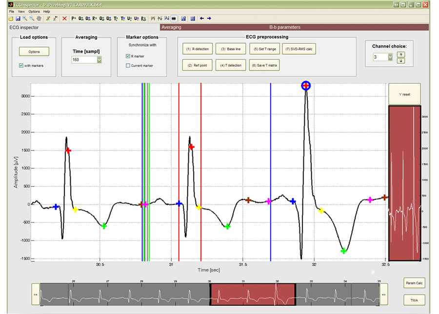 Segmentacja EKG