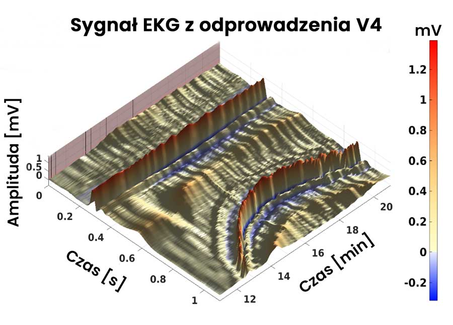 Zmienność EKG